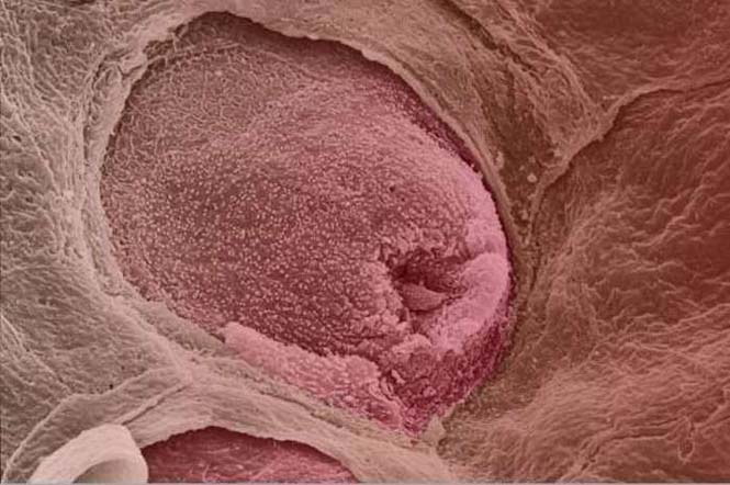 Το ανθρώπινο σώμα στο μικροσκόπιο (9)