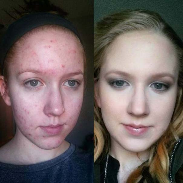 Πως το μακιγιάζ μπορεί να «εξαφανίσει» τα δερματικά προβλήματα των γυναικών (18)