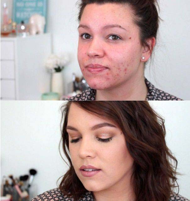 Πως το μακιγιάζ μπορεί να «εξαφανίσει» τα δερματικά προβλήματα των γυναικών (21)