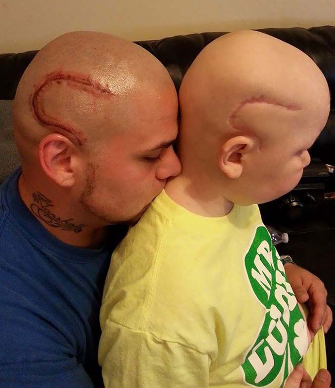 Πατέρας έκανε τατουάζ ίδιο με την ουλή του καρκινοπαθή γιου του για συμπαράσταση (3)