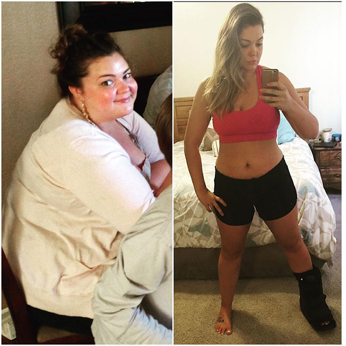 Η εκπληκτική μεταμόρφωση μιας κοπέλας που έχασε 84 κιλά (2)