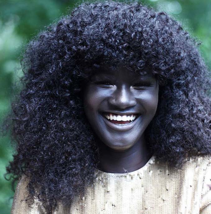 Έφηβη δέχτηκε εκφοβισμό για το απίστευτα σκούρο δέρμα της, έγινε μοντέλο και κατέκτησε το Internet (1)