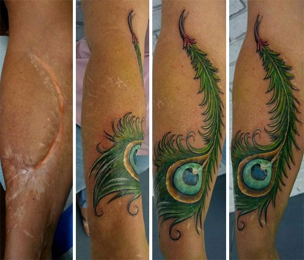Εκπληκτικά τατουάζ που μετέτρεψαν ουλές σε έργα τέχνης (21)