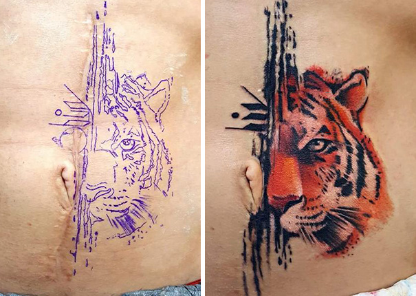 Εκπληκτικά τατουάζ που μετέτρεψαν ουλές σε έργα τέχνης (25)