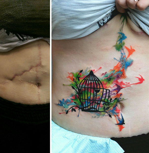 Εκπληκτικά τατουάζ που μετέτρεψαν ουλές σε έργα τέχνης (29)