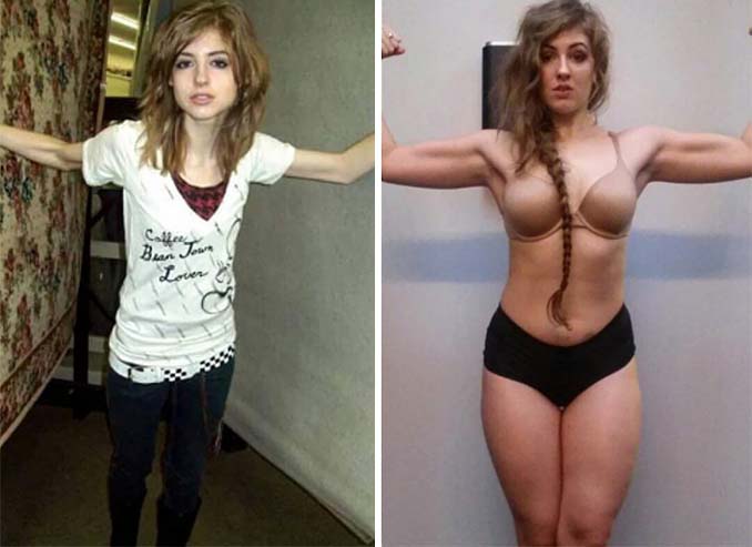 Πριν και Μετά - Εκπληκτικές φωτογραφίες ανθρώπων που νίκησαν την ανορεξία (23)